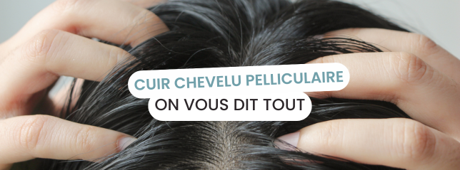 Pellicules dans les cheveux, que faire Pellicules dans les cheveux, que faire