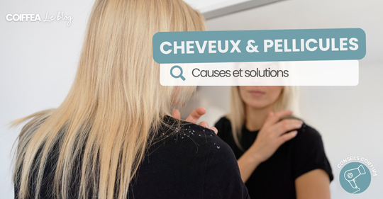 Pellicules dans les cheveux, que faire