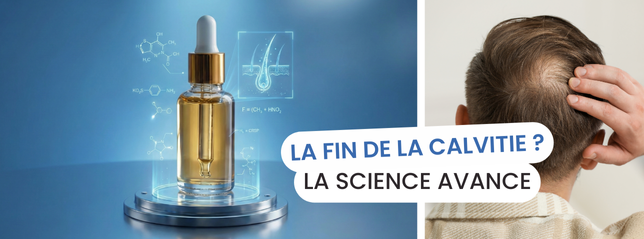 La calvitie, bientot un traitement miracle (1) La calvitie, bientot un traitement miracle (1)